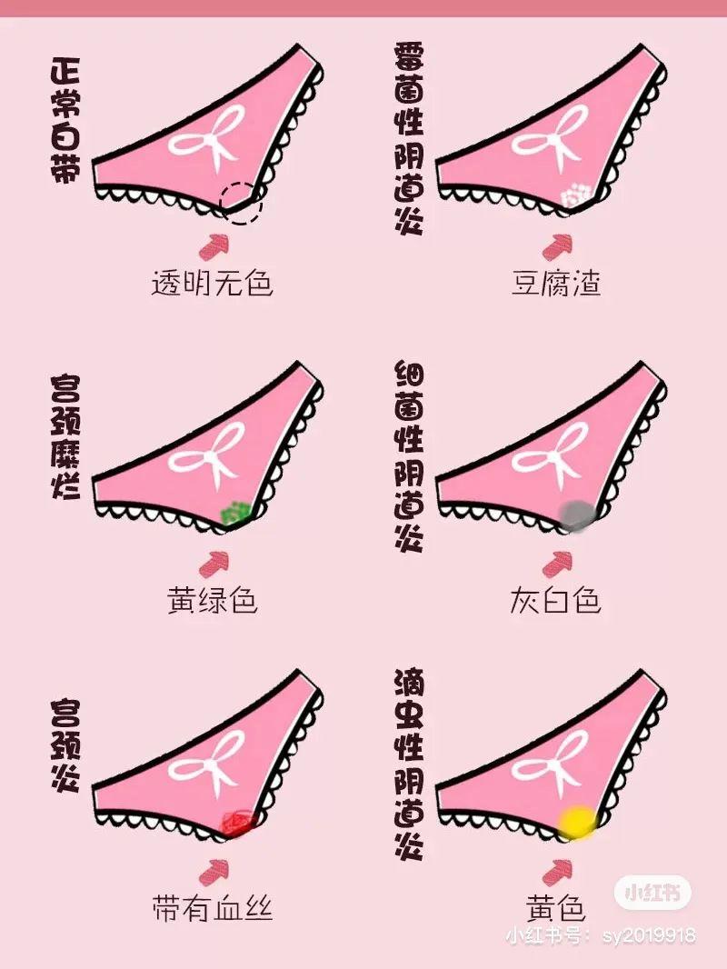 女生“不检点”私处会变黑？醒醒吧你！