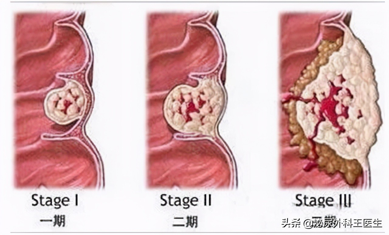 专家告诉你答案