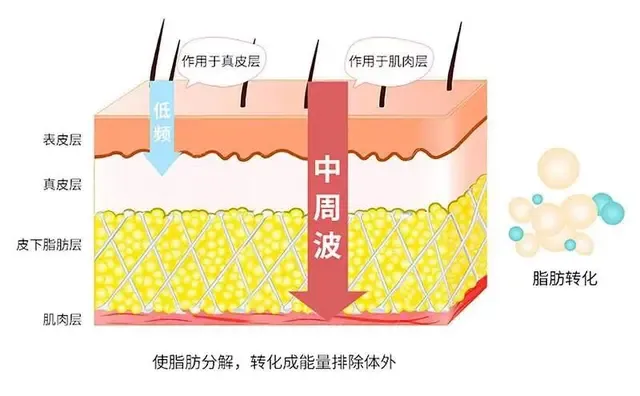 1000个跳绳消耗多少卡路里（1000跳绳相当于几公里）